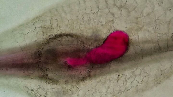 Fêmea sedentária de nematoide de galha dentro de uma raiz com sintoma de galha e conjunto de células gigantes.